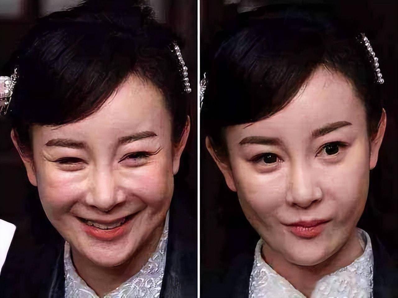 被整容耽误的女明星_娱乐圈没整过容的明星_赵樱子整容前后对比
